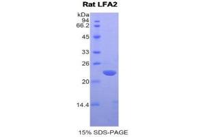SDS-PAGE (SDS) image for CD2 (CD2) (AA 27-203) protein (His tag) (ABIN1878380)