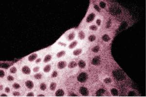 Immunofluorescent staining of MDCK cells with anti-FAS antibody. (Fatty Acid Synthase Antikörper  (AA 9-202))