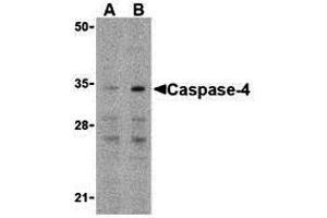 Western Blotting (WB) image for anti-Caspase 4, Apoptosis-Related Cysteine Peptidase (CASP4) (N-Term) antibody (ABIN1031297) (Caspase 4 Antikörper  (N-Term))