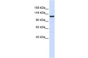 IGSF1 antibody used at 1 ug/ml to detect target protein. (IGSF1 Antikörper  (N-Term))