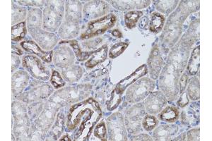 Immunohistochemistry of paraffin-embedded mouse kidney using ITGAV antibody (ABIN1873308) at dilution of 1:50 (40x lens).