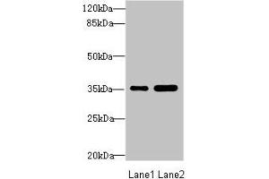 Western blot All lanes: TOB2 antibody at 1. (TOB2 Antikörper  (AA 1-70))