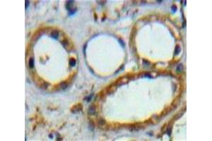 Used in DAB staining on fromalin fixed paraffin-embedded Kidney tissue (CD3D Antikörper  (AA 18-113))
