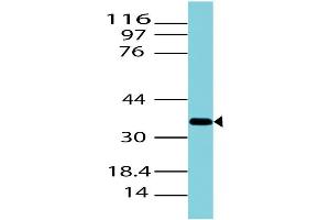 Image no. 1 for anti-Arginase (ARG) (AA 4-230) antibody (ABIN5027037) (ARG Antikörper  (AA 4-230))