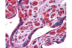 UCHL3 antibody was used for immunohistochemistry at a concentration of 4-8 ug/ml. (UCHL3 Antikörper)