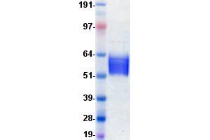 Western Blotting (WB) image for Fibroblast Growth Factor Receptor 4 (FGFR4) protein (DYKDDDDK-His Tag) (ABIN2713674)
