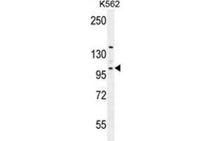 VILL Antibody (Center) western blot analysis in K562 cell line lysates (35 µg/lane).