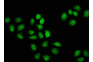 Immunofluorescence staining of Hela cells with ABIN7153843 at 1:133, counter-stained with DAPI. (GANP Antikörper  (AA 292-435))