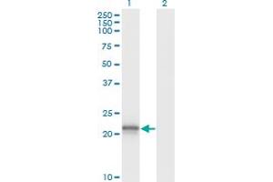 Western Blotting (WB) image for anti-Von Hippel-Lindau Tumor Suppressor, E3 Ubiquitin Protein Ligase (VHL) (AA 1-110) antibody (ABIN563371)