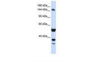 Image no. 1 for anti-ABI Family, Member 3 (NESH) Binding Protein (ABI3BP) (AA 144-193) antibody (ABIN6738309) (ABI3BP Antikörper  (AA 144-193))