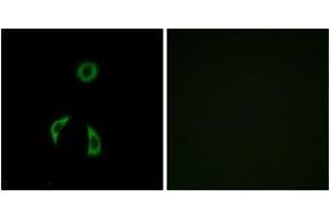 Immunofluorescence analysis of A549 cells, using FZD3 Antibody. (FZD3 Antikörper  (AA 481-530))