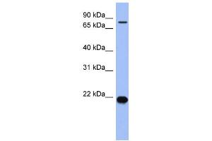 WB Suggested Anti-ZNF800 Antibody Titration:  0. (ZNF800 Antikörper  (N-Term))