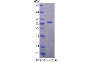 SDS-PAGE analysis of Mouse LYPLA1 Protein. (LYPLA1 Protein)