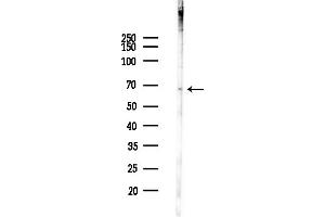 anti-Synovial Apoptosis Inhibitor 1, Synoviolin (SYVN1) (Internal Region) antibody