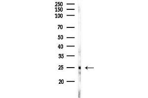 Western blot analysis of lysates from EC304 cells, using HMG Antibody at 1/1000 dilution.
