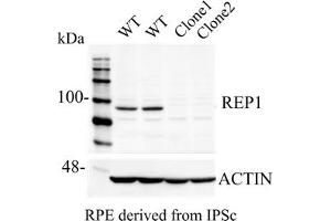 Western Blotting (WB) image for anti-Choroideremia (Rab Escort Protein 1) (CHM) (C-Term) antibody (ABIN6254222) (CHM Antikörper  (C-Term))