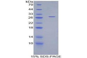 SDS-PAGE (SDS) image for Myocilin (MYOC) (AA 224-471) protein (His tag) (ABIN2121658) (MYOC Protein (AA 224-471) (His tag))