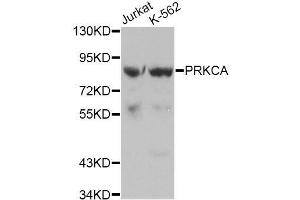 Western blot analysis of extracts of various cell lines, using PRKCA antibody. (PKC alpha Antikörper  (C-Term))