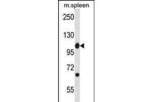 Mouse Abl1 Antibody (Center) (ABIN657828 and ABIN2846795) western blot analysis in mouse spleen tissue lysates (35 μg/lane). (ABL1 Antikörper  (AA 613-641))