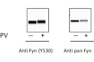 293 cells were treated or untreated with Pervanadate. (FYN ELISA Kit)