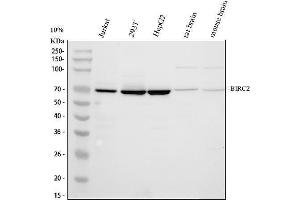 Western blot analysis of cIAP1/BIRC2 using anti-cIAP1/BIRC2 antibody (ABIN5693185). (BIRC2 Antikörper  (AA 320-570))