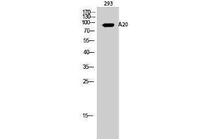 Western Blotting (WB) image for anti-Immunoglobulin kappa Variable 1-27 (IGKV1-27) (Internal Region) antibody (ABIN3173607) (IGKV1-27 Antikörper  (Internal Region))
