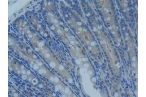Detection of MMP14 in Mouse Intestine Tissue using Polyclonal Antibody to Matrix Metalloproteinase 14 (MMP14) (MMP14 Antikörper  (AA 121-487))