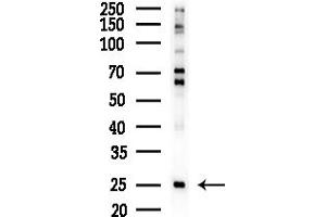 anti-Mitochondrial Ribosomal Protein L16 (MRPL16) (Internal Region) antibody