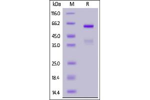 SDS-PAGE (SDS) image for HLA-DR-gamma (CD74) (AA 73-232) protein (Fc Tag) (ABIN6992394)