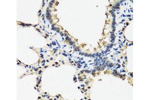 Immunohistochemistry of paraffin-embedded Rat lung using ARSF Polyclonal Antibody at dilution of 1:100 (40x lens). (ARSF Antikörper)