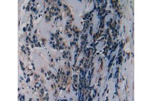 Used in DAB staining on fromalin fixed paraffin- embedded breast cancer tissue (SLURP1 Antikörper  (AA 1-103))