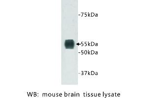 Image no. 1 for anti-Transmembrane Protein 132A (TMEM132A) antibody (ABIN1112938) (TMEM132A Antikörper)