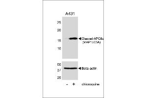 Western blot analysis of lysates from A431 cell line, untreated or treated with chloroquine, 100 ng/mL, using Cleaved-G8a (M1LC3A) 1805a (upper) or Beta-actin (lower).