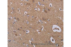 Immunohistochemistry of Human brain  using ZC3H12A Polyclonal Antibody at dilution of 1:40