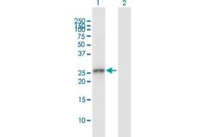 Western Blot analysis of GCLM expression in transfected 293T cell line by GCLM MaxPab polyclonal antibody.
