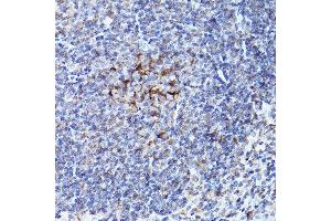 Immunohistochemistry of paraffin-embedded mouse spleen using BOK Rabbit pAb (ABIN7265866) at dilution of 1:100 (40x lens). (BOK Antikörper  (AA 1-100))