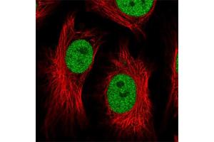 Immunofluorescent staining of human cell line HeLa with ATF1 polyclonal antibody  at 1-4 ug/mL concentration shows positivity in nucleus but excluded from the nucleoli.