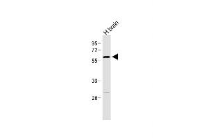 Anti-RORA Antibody  at 1:500 dilution + Human brain lysate Lysates/proteins at 20 μg per lane. (RORA Antikörper  (AA 193-222))