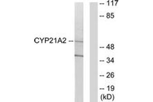 Western blot analysis of extracts from 293 cells, using Cytochrome P450 21A2 Antibody. (CYP21A2 Antikörper  (AA 151-200))