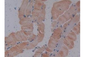 Immunohistochemistry (IHC) image for anti-ATPase, Na+/K+ Transporting, beta 3 Polypeptide (ATP1B3) (AA 61-277) antibody (ABIN7432448)