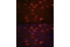 Immunofluorescence analysis of mouse brain using SLC18 Rabbit pAb (ABIN7270410) at dilution of 1:100 (40x lens). (SLC18A3 Antikörper  (AA 1-150))