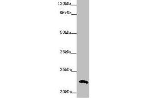 Western blot All lanes: PPIF antibody at 5. (PPIF Antikörper  (AA 30-207))