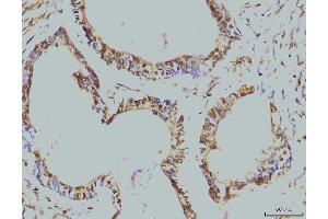 IHC analysis of RPA32/RPA2 using anti-RPA32/RPA2 antibody (ABIN7601379). (RPA2 Antikörper  (AA 34-254))