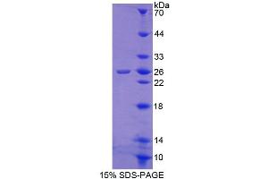 SDS-PAGE analysis of Human CALN1 Protein. (Calneuron 1 Protein (CALN1))