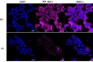 Immunocytochemical staining of HeLa cells using IKK alpha antibody (ABIN7798147), 1:1,000), Top panel: wild-type (WT), Bottom panal: IKK alpha shRNA knockdown (KD). (Rekombinanter IKK alpha Antikörper)