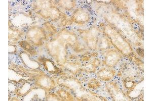 ABIN6254866 and ABIN6274062 at 1/100 staining human normal kidney tissue by IHC-P.