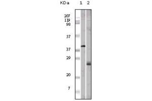 Western blot analysis using ApoM antibody against GST-ApoM recombinant protein (1) and human serum (2).