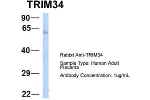 Host:  Rabbit  Target Name:  TRIM34  Sample Type:  Human Adult Placenta  Antibody Dilution:  1. (TRIM34 Antikörper  (N-Term))
