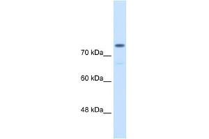 WB Suggested Anti-ACTN4 Antibody Titration:  0. (alpha Actinin 4 Antikörper  (C-Term))