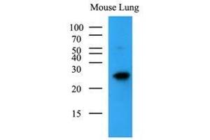 Mouse lung lysates (35 ug) were resolved by SDS-PAGE, transferred to nitrocellulose membrane and probed with anti-human BAK1 (1:500). (BAK1 Antikörper  (AA 29-187))